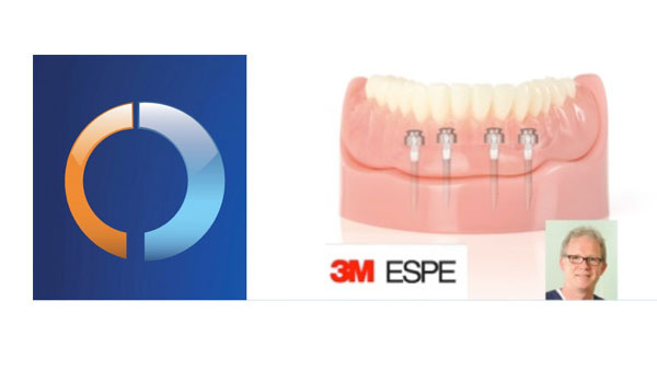 Mini-Dental-Implantate