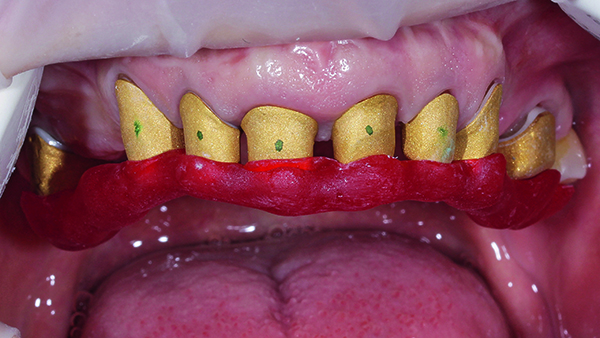 3D-Druck Zahnarztpraxis
