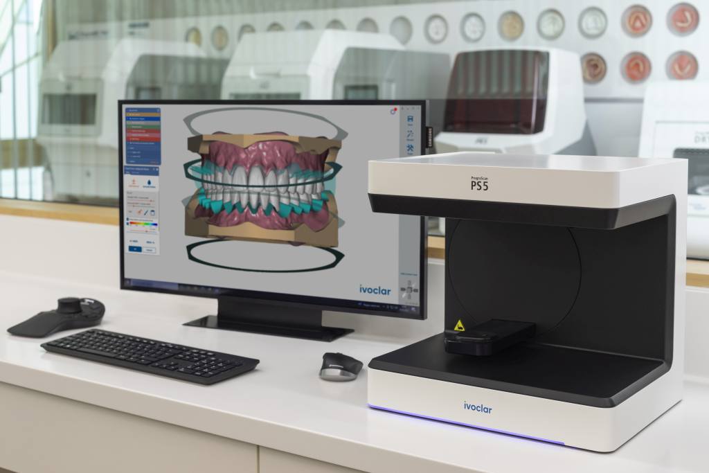 Die Integration des Ivotion Denture Add-on-Moduls in die exocad DentalCAD-Software ermöglicht einen vollständig digitalen Herstellungsprozess für hochwertigen Zahnersatz.